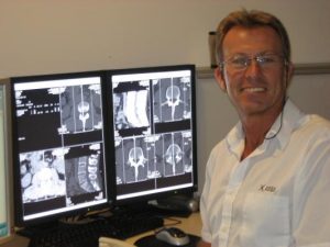 Osteoporosis: It’s no humerus matter