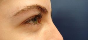 Treating diseases that may rob sight