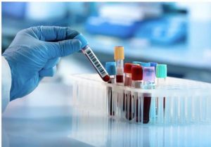 Blood tests and preparation strategies